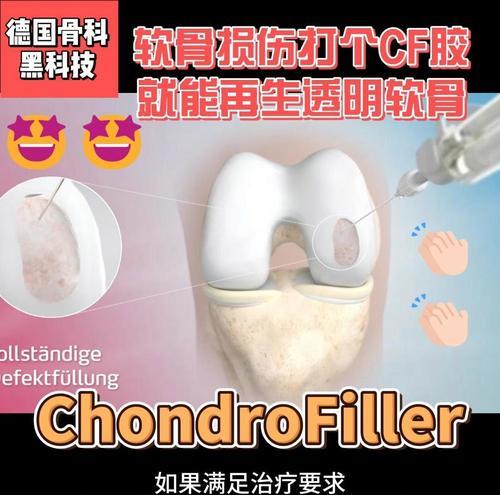 cf软骨再生术的费用是多少？
